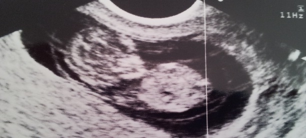 Name:  baby 1.jpg
Views: 83
Size:  59.4 KB