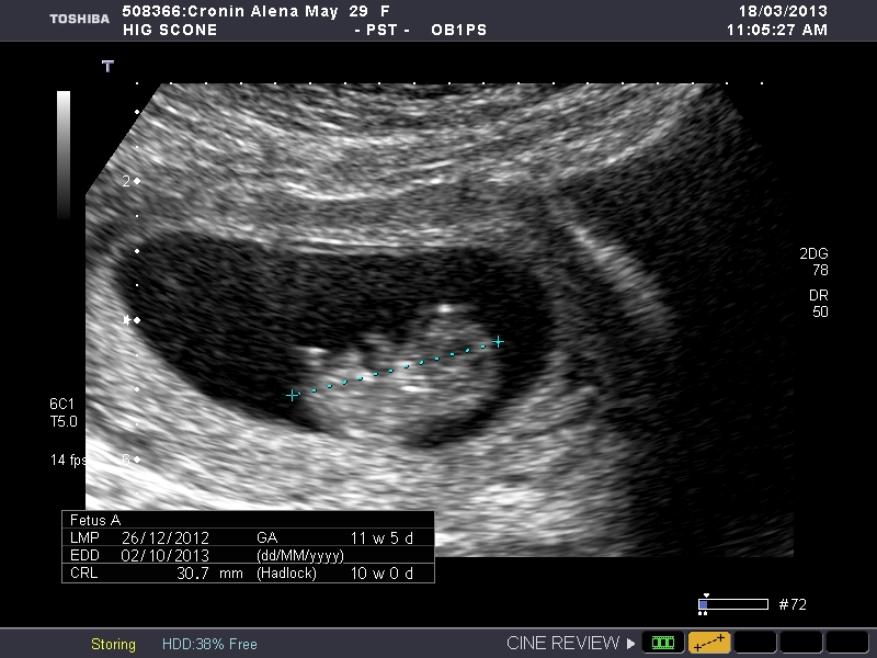 Name:  bub 003.jpg
Views: 112
Size:  232.2 KB
