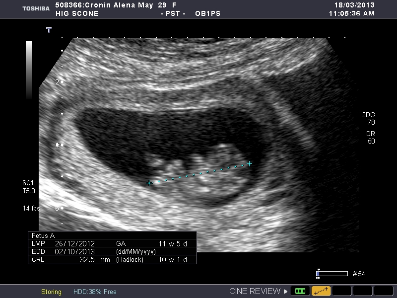 Name:  bub 004.jpg
Views: 95
Size:  236.5 KB