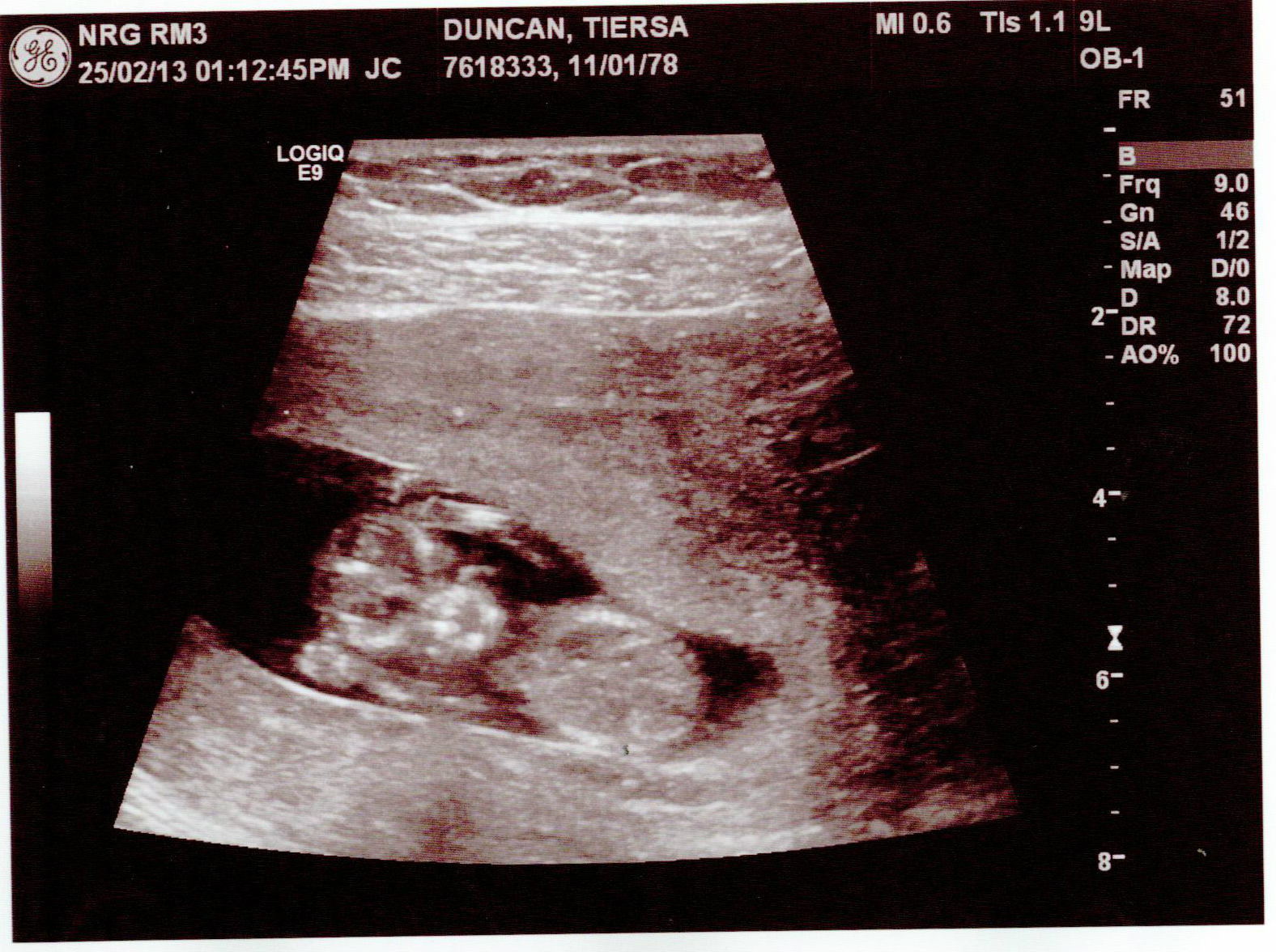 Name:  BabyDavis.JPG
Views: 191
Size:  1.81 MB