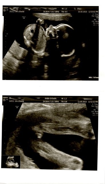 Name:  potty shot 20w.jpg
Views: 175
Size:  69.3 KB