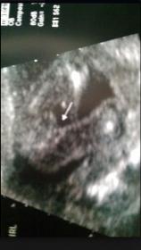 Name:  Screen shot 2013-03-25 at 10.44.07 AM.jpg
Views: 166
Size:  7.6 KB