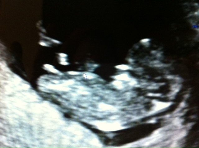 Name:  baby medium scan.jpg
Views: 345
Size:  90.4 KB