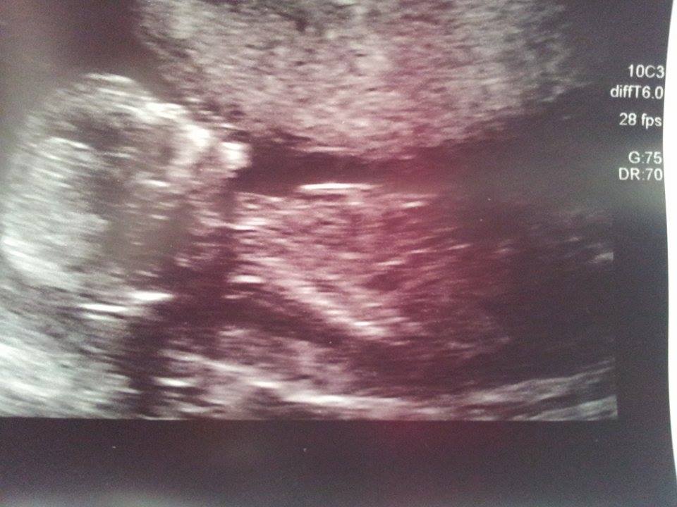 Name:  baby.jpg
Views: 399
Size:  77.3 KB