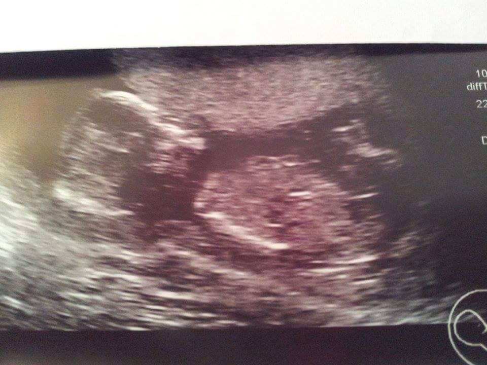 Name:  baby 10.jpg
Views: 262
Size:  67.2 KB