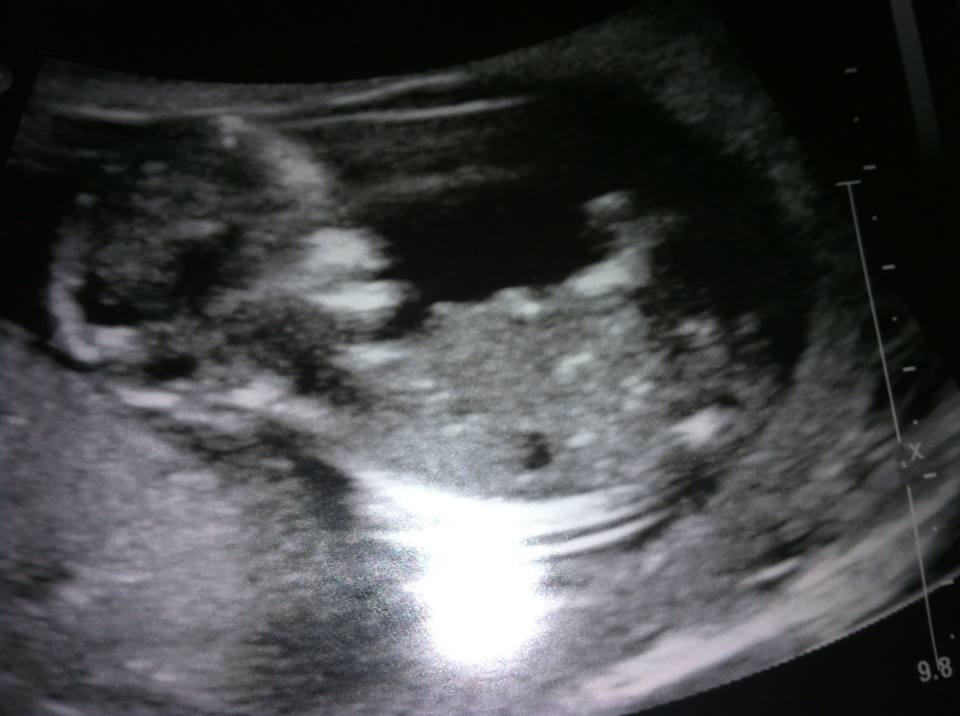 Name:  10176113_10203696985405666_3348743694708321544_n.jpg
Views: 541
Size:  50.2 KB