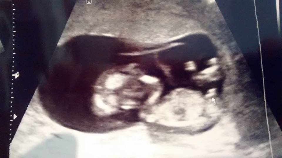 Name:  us.jpg
Views: 259
Size:  40.6 KB