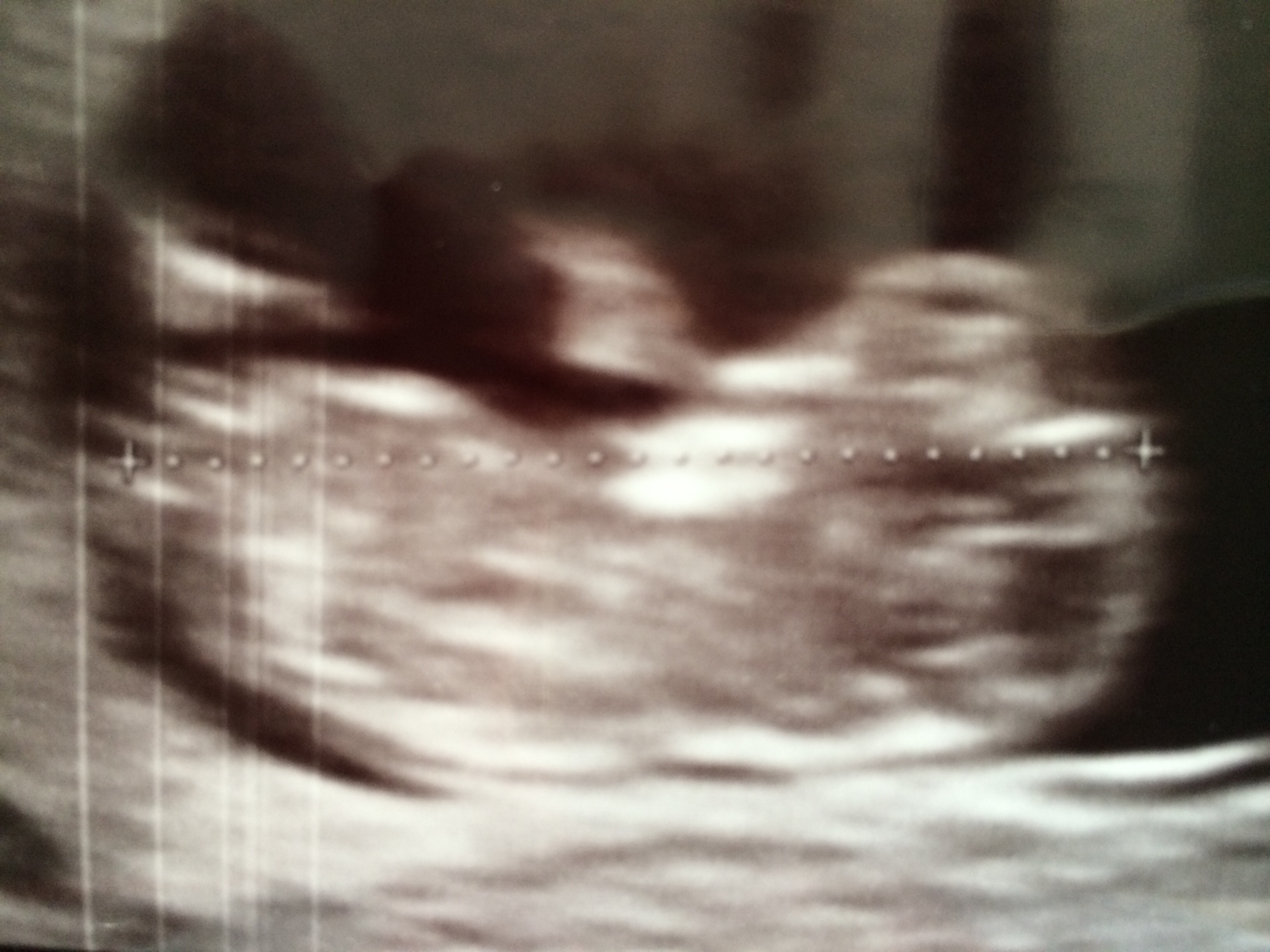 Name:  image.jpg
Views: 203
Size:  1.26 MB