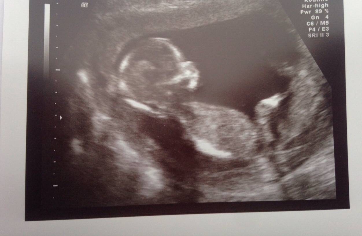 Name:  image.jpg
Views: 641
Size:  234.2 KB