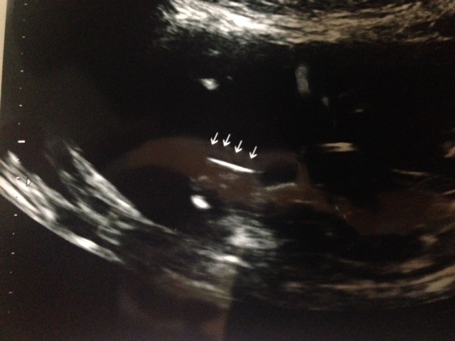 Name:  photo 2.JPG
Views: 125
Size:  93.8 KB