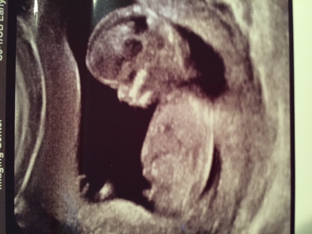 Name:  IMG_3910.JPG
Views: 598
Size:  84.8 KB