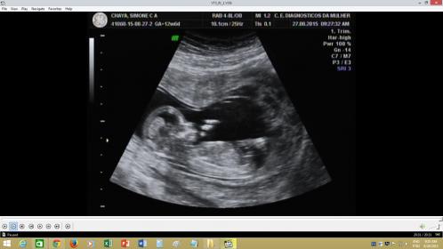 Name:  !cid_ii_14f744538596418c.jpg
Views: 299
Size:  18.1 KB