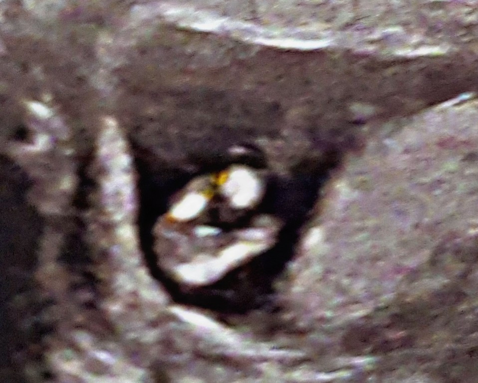 Name:  PicsArt_02-07-11.01.53.jpg
Views: 323
Size:  167.2 KB