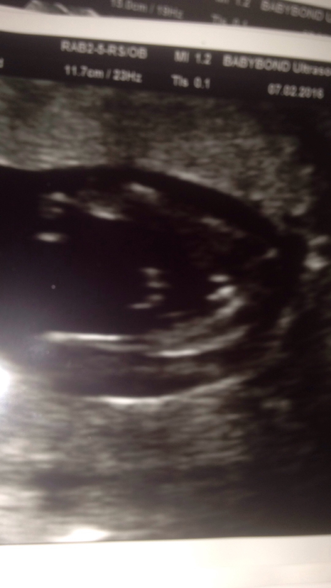 16 weeks 3 days potty shot