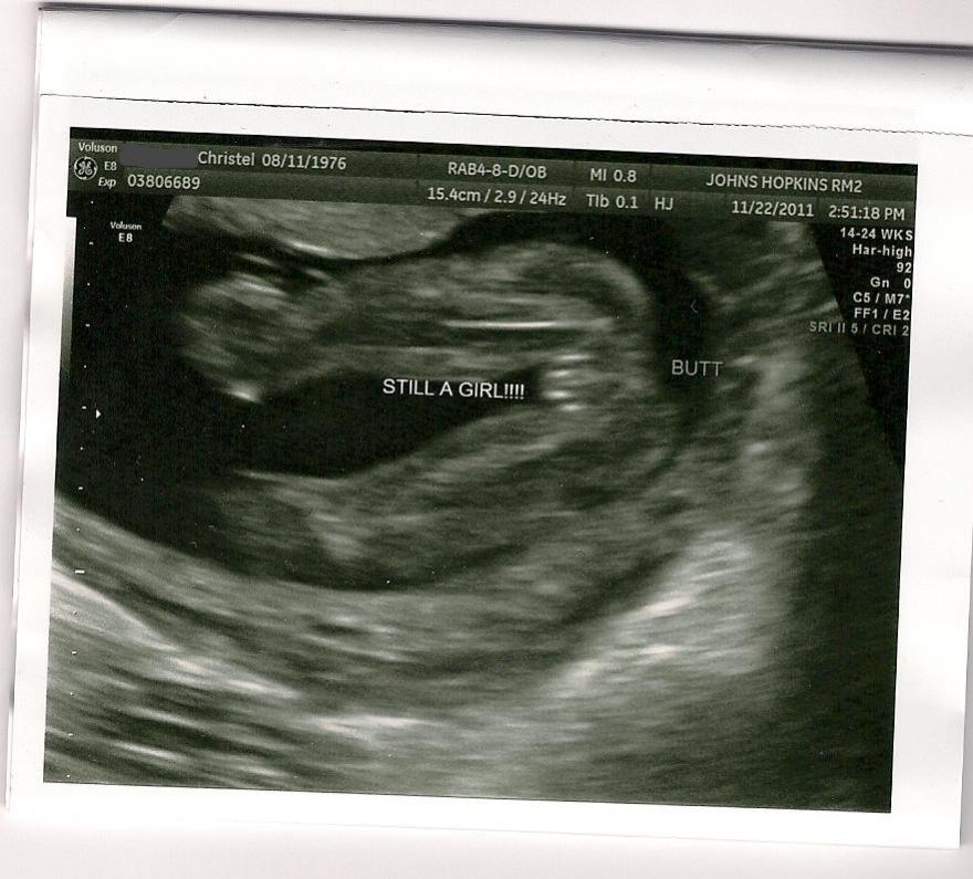 Name:  Baby 20 weeks.jpg
Views: 15780
Size:  90.9 KB