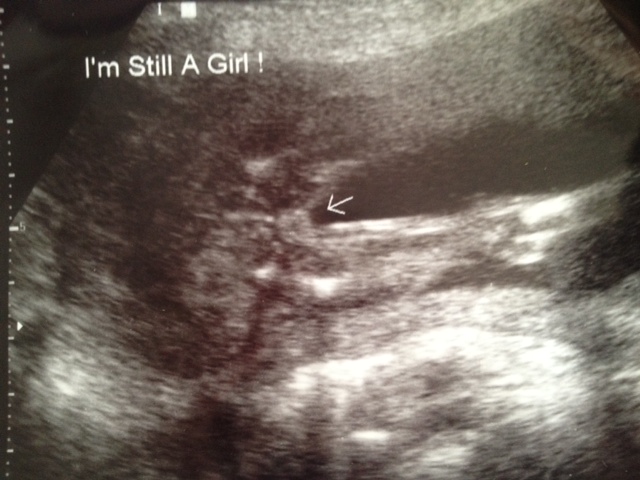 Name:  ella 20w2photo.JPG
Views: 2223
Size:  111.0 KB