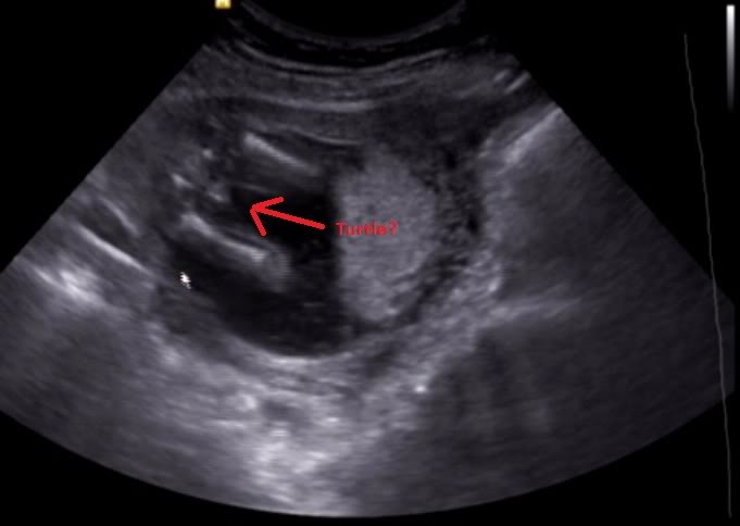 Name:  charlee-ultrasound.jpg
Views: 59511
Size:  23.6 KB