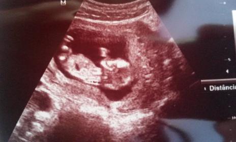 Name:  baby at 12 weeks.jpg
Views: 150
Size:  18.8 KB