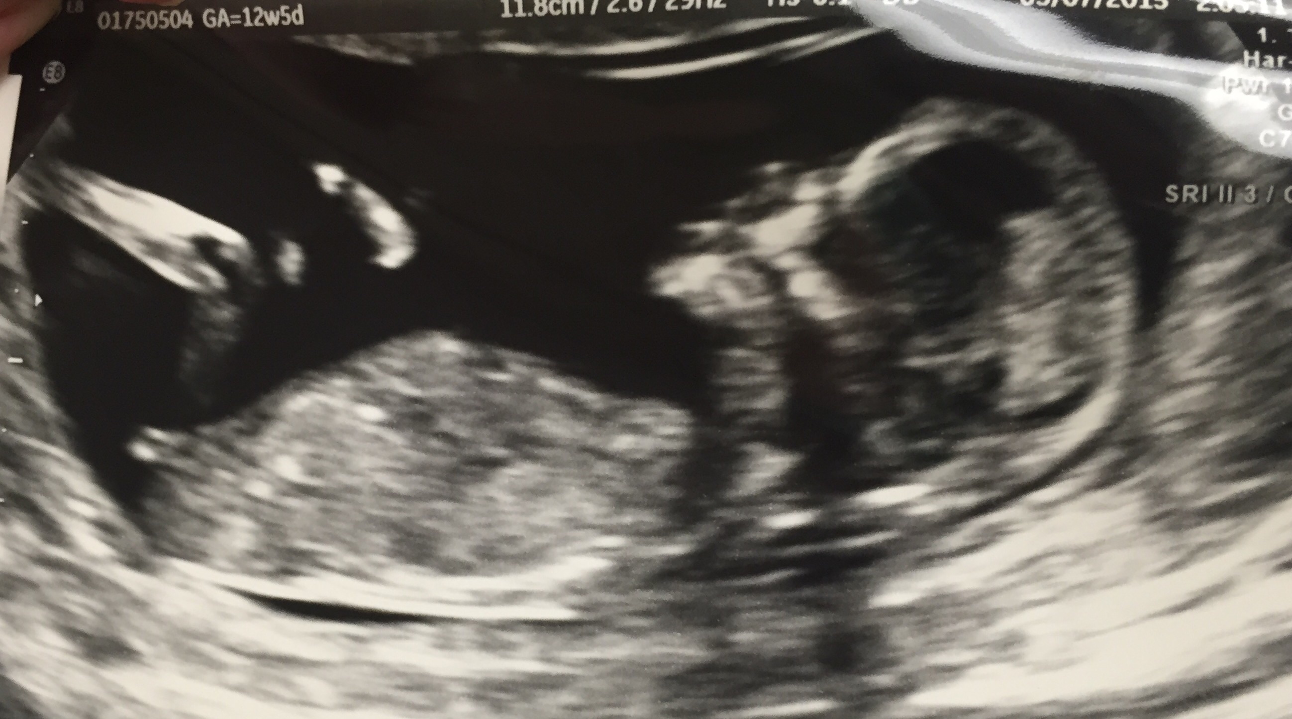 12 week 5 day nub!!