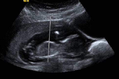 Name:  new baby 4 hb (2).bmp
Views: 494
Size:  462.0 KB