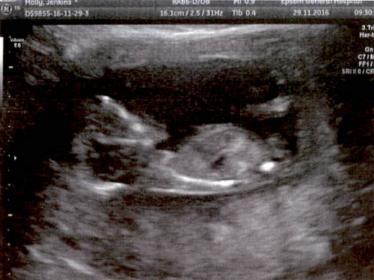 Name:  Baby.jpg
Views: 183
Size:  18.5 KB