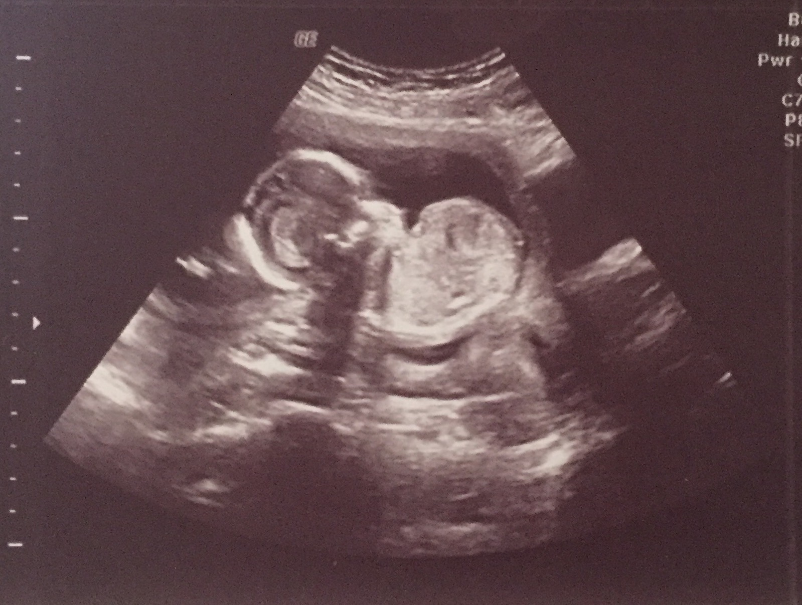 Name:  ultrasound2.jpg
Views: 345
Size:  371.9 KB