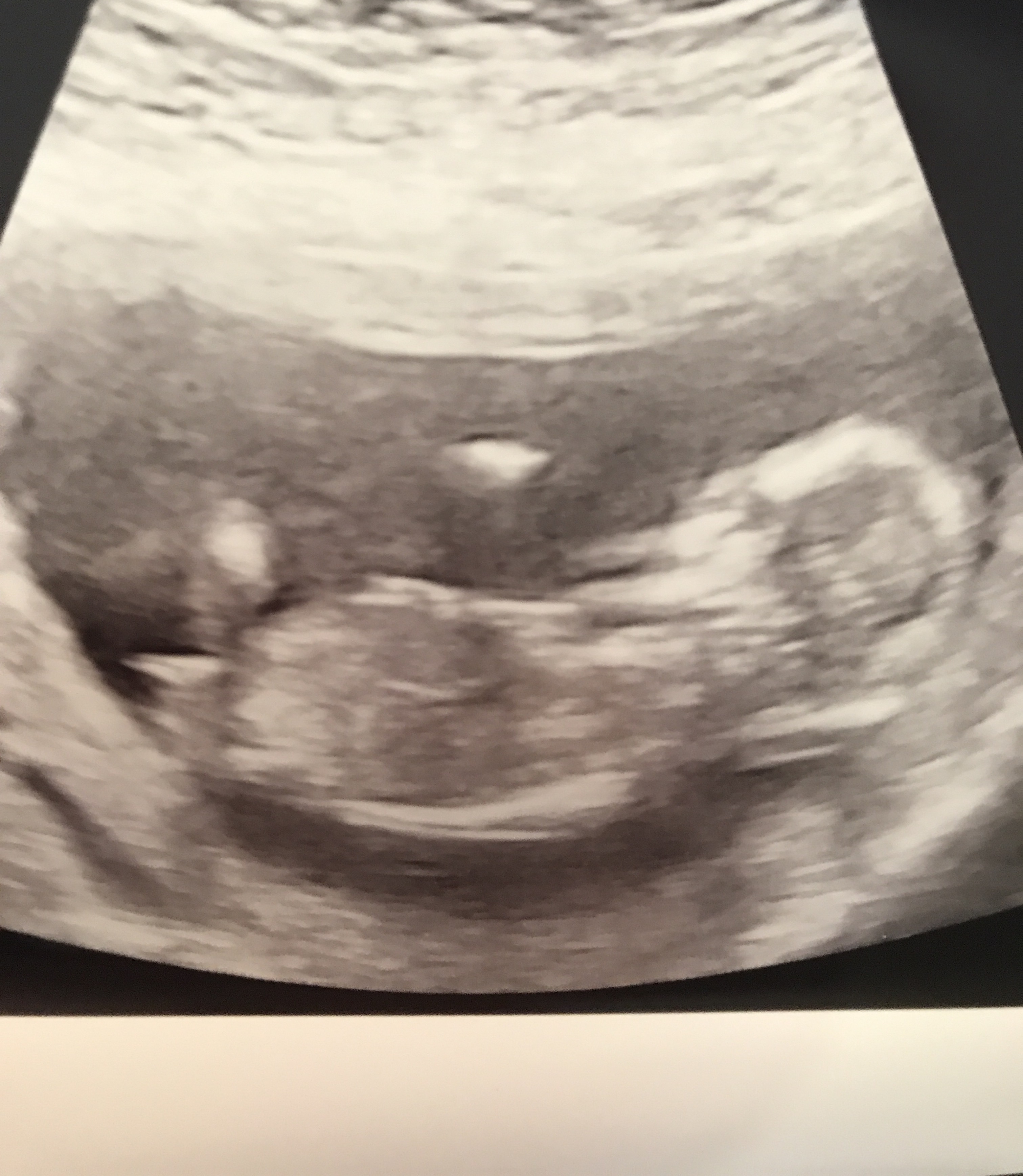 13 weeks 3 days boy or girl nub?