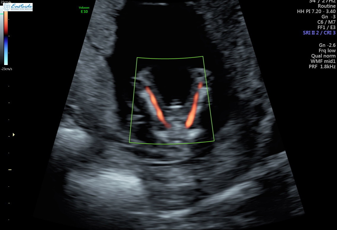 13-week-ultrasound-pics-please-confirm-gender