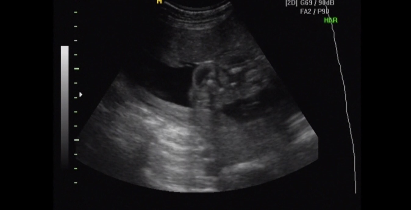 Name:  Baby #5 Ultrasound.jpg
Views: 215
Size:  73.6 KB