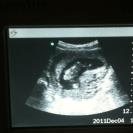 Name:  Haley sonogram April 2013 baby 2.jpg
Views: 101
Size:  4.0 KB