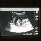 Name:  Haley sonogram April 2013 baby 3.jpg
Views: 134
Size:  14.8 KB