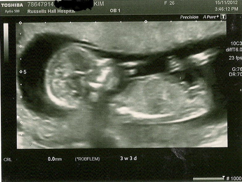 Name:  scan 1 baby sherwood.jpg
Views: 12440
Size:  205.8 KB