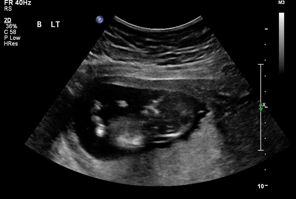 Name:  Baby B nub shot(2).jpg
Views: 1015
Size:  177.6 KB