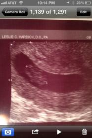 Name:  8 week ultrasound.jpg
Views: 281
Size:  10.3 KB