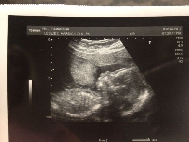 Name:  profile ultrasound.JPG
Views: 304
Size:  96.9 KB