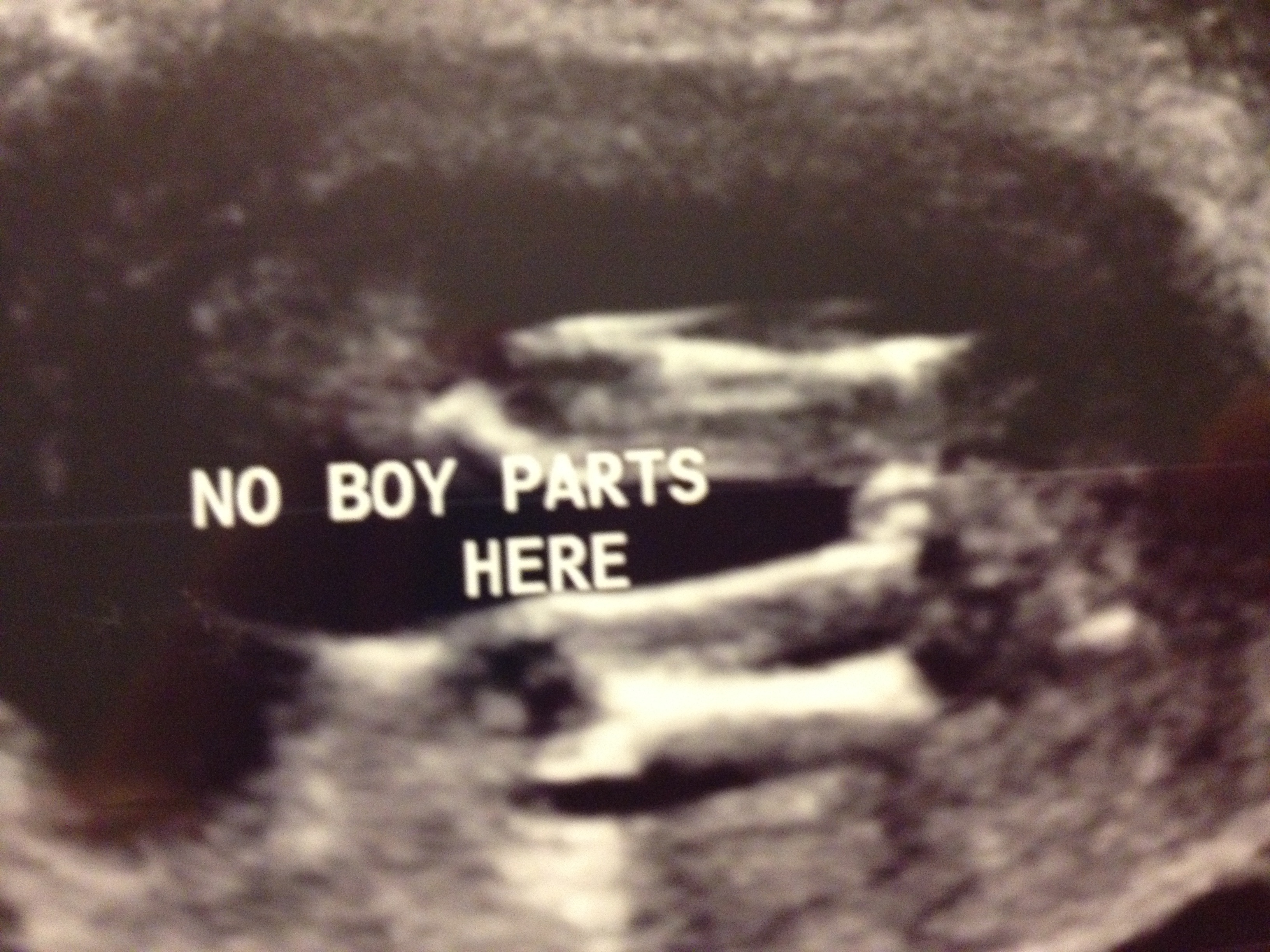 16 week ultrasound pic of girl?