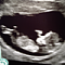 LoubyLou's Avatar